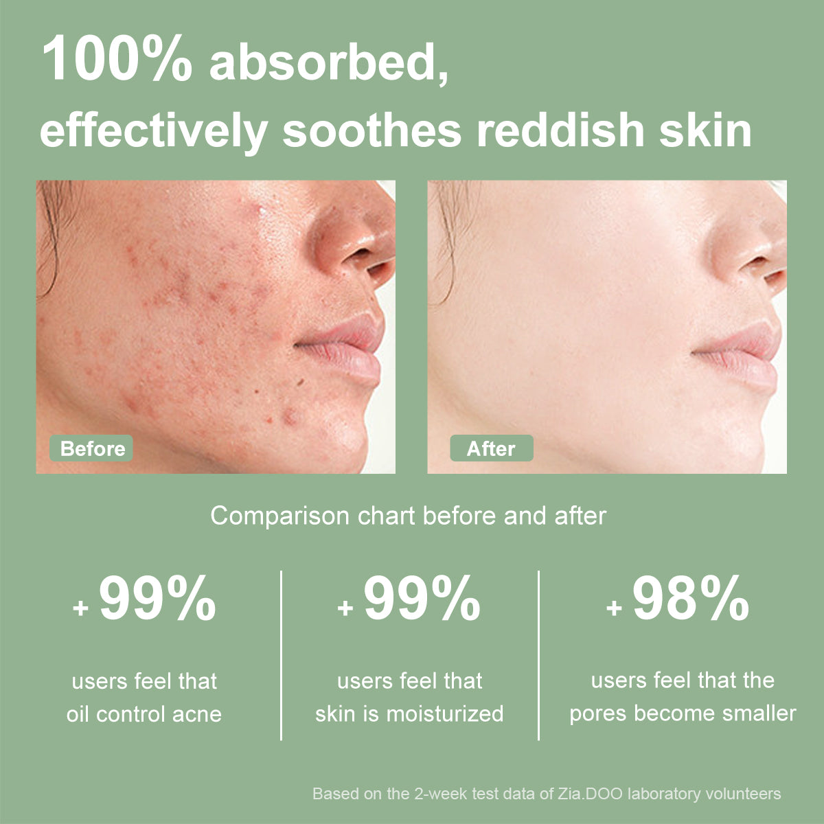 ZIA.DOO SALICYLIC ACID ACNE SERUM (SINGLE USE) 1.5ml*10